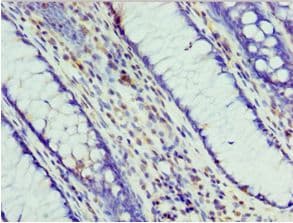 Polyclonal Rabbit anti-Human Prohibitin 2 / PHB2 Antibody (aa1-299, IHC, WB)