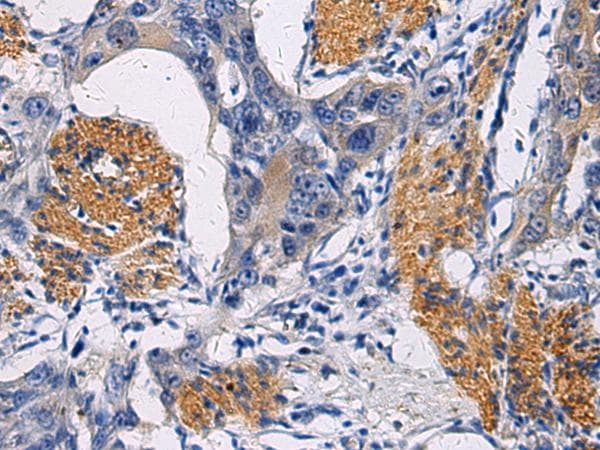FAM20C Antibody