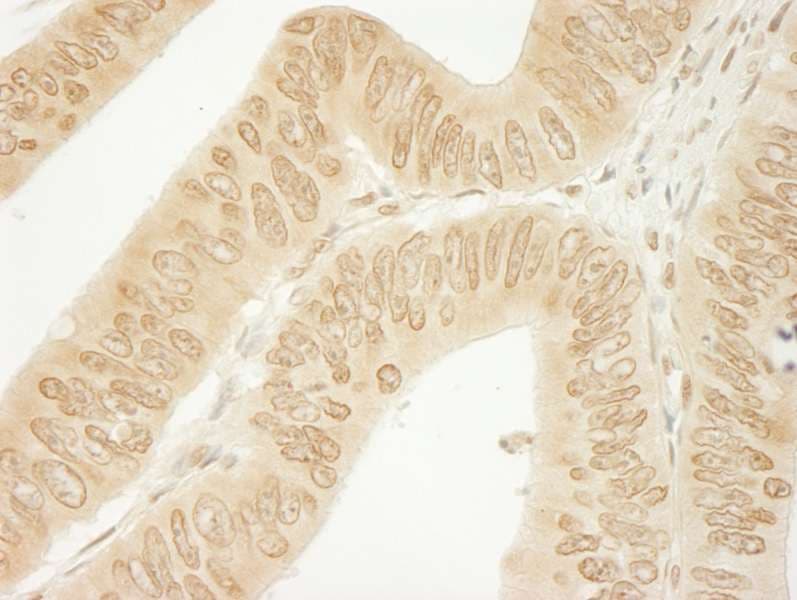 CTNND1 / p120 Catenin Antibody (aa625-675)