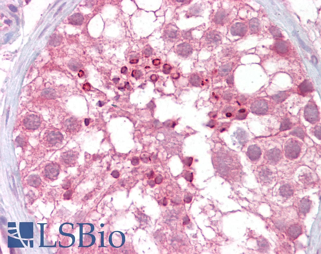 IHC-plus™ Polyclonal Goat anti-Human USP28 Antibody (aa674-685, IHC)