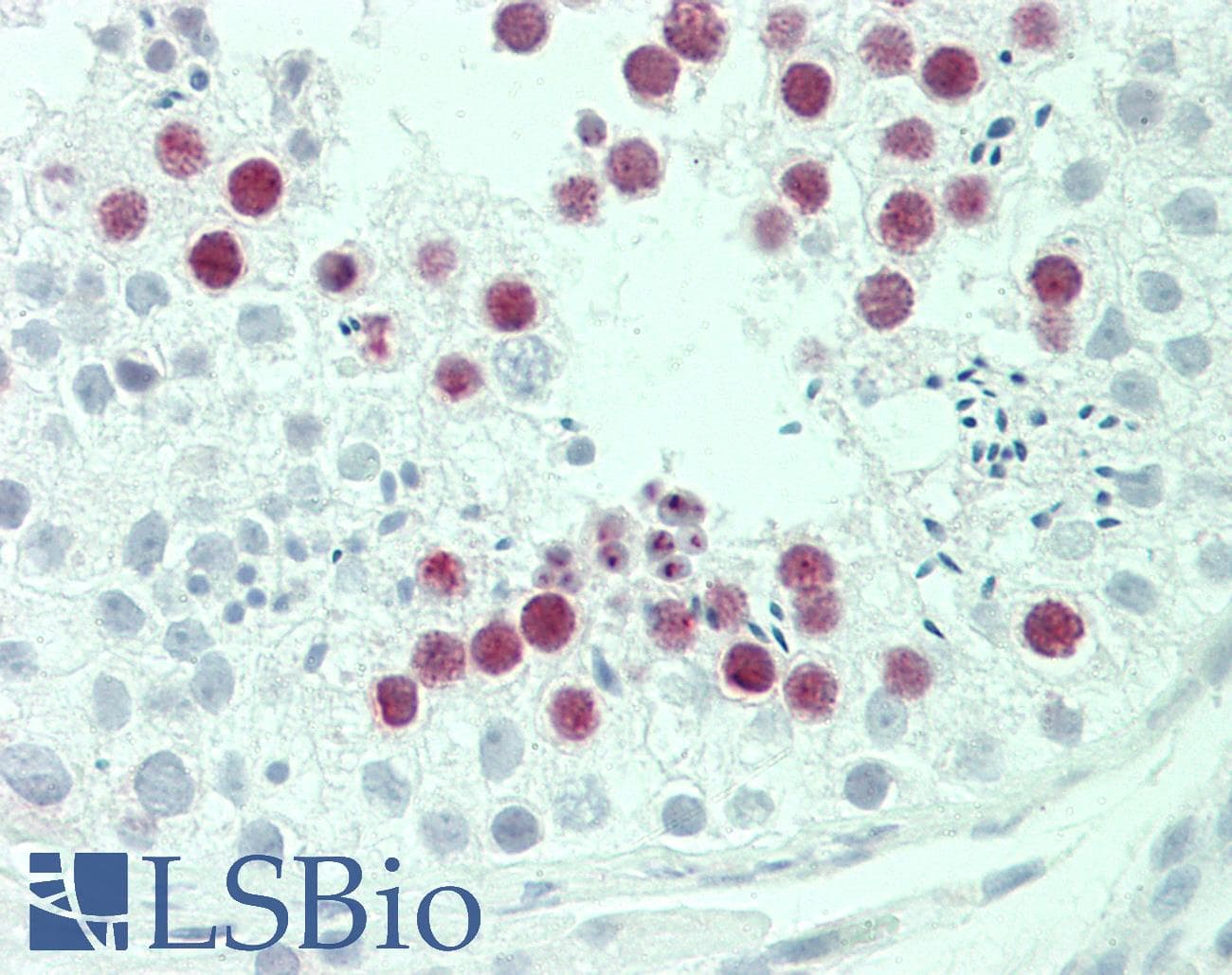 IHC-plus™ SYCE2 Antibody (aa1-30)