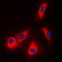 ADK / Adenosine Kinase Antibody (N-Terminus)