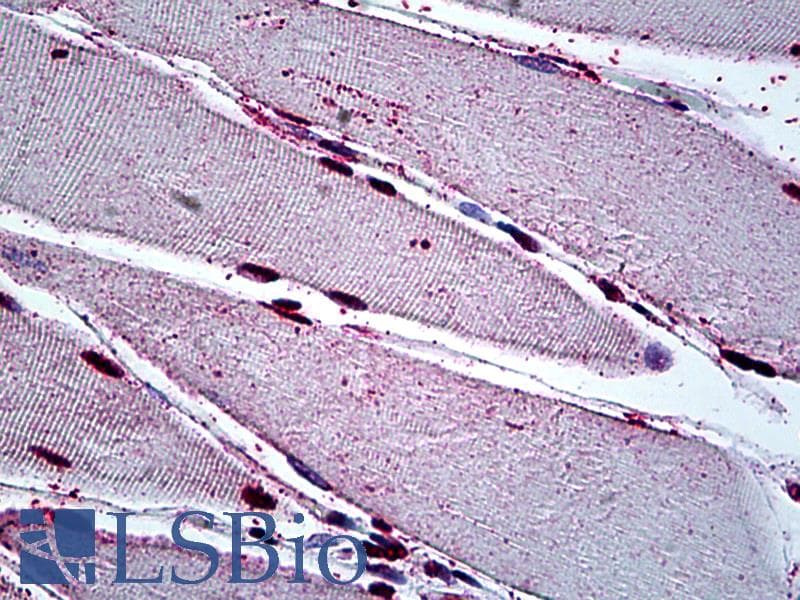 IHC-plus™ GAX / MEOX2 Antibody (clone 6A5)