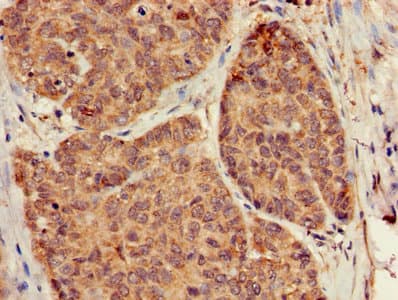 Polyclonal Rabbit anti-Human GB5 / GNB5 Antibody (aa1-353, WB)