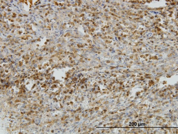 IL31RA Antibody (clone 3A10)