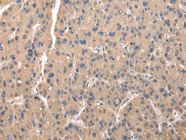 ZFAND5 Antibody