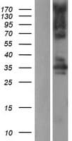 STK16 Protein (Over-Expression Lysate Myc-DDK (Flag))