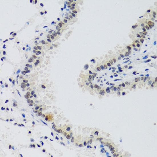 Polyclonal Rabbit anti-Human CCNE2 / Cyclin E2 Antibody (IHC)