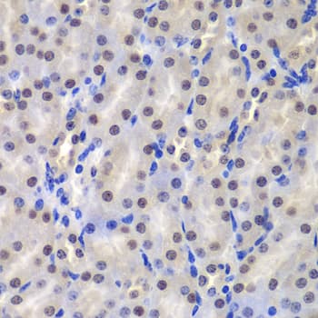 Polyclonal Rabbit anti-Human GSTP1 / GST Pi Antibody (IHC, IF, WB)
