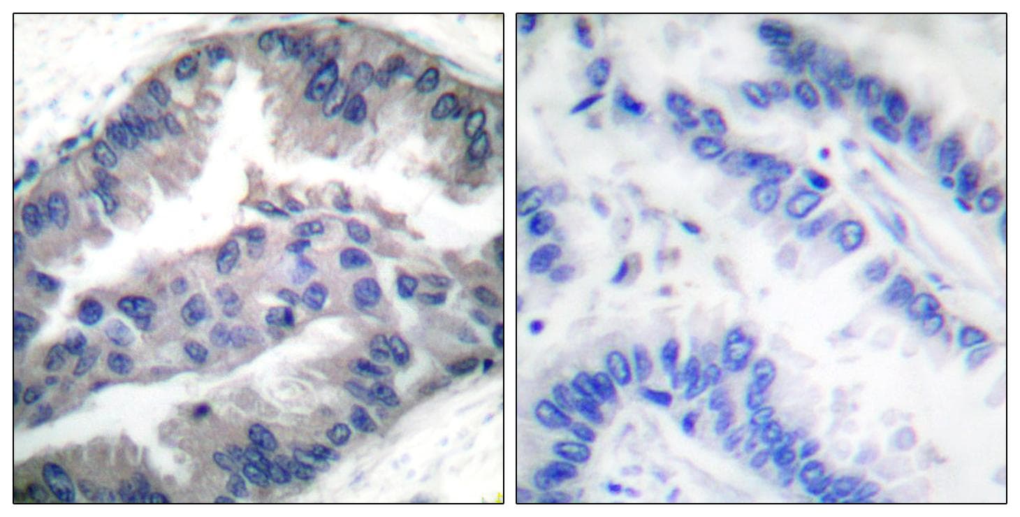 Polyclonal Rabbit anti-Human BIK Antibody (phospho-Thr33, IHC, WB)