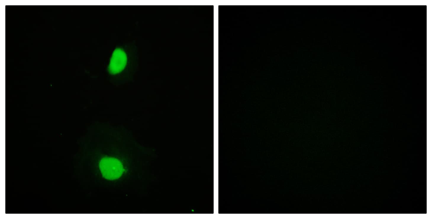 Polyclonal Rabbit anti-Human KAT5 / TIP60 Antibody (aa52-101, IHC, IF)