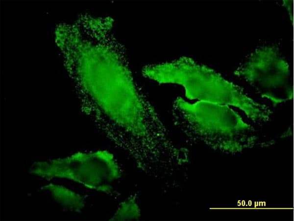 IHC-plus™ Monoclonal Mouse anti-Human RPS7 / Ribosomal Protein S7 Antibody (clone 3G4, IHC, IF, WB)
