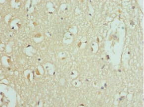 SLC25A20 / CACT Antibody