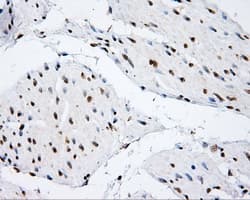 p66 / SHC Antibody (clone OTI3A1)