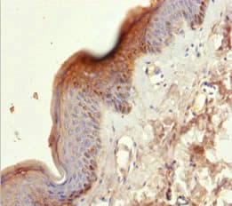 KRT6A / CK6A / Cytokeratin 6A Antibody