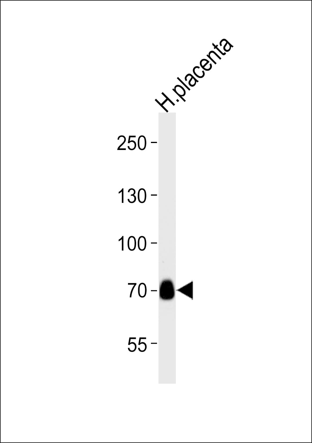 NEK11 Antibody (aa480-510)