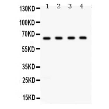 APBB1 / FE65 Antibody (aa21-56)