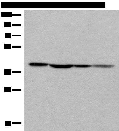 ROM1 Antibody