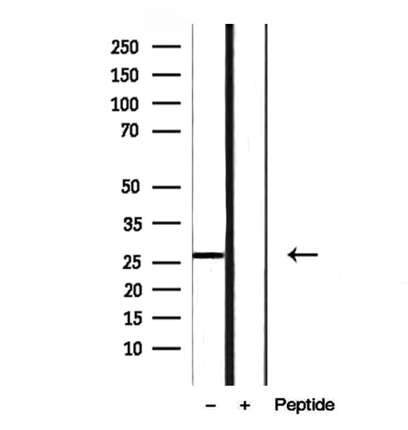 RAB27B Antibody