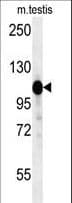 Polyclonal Rabbit anti-Human DACT1 / DAPPER Antibody (aa13-41, IHC, WB)