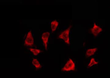 OR2T3 + OR2T34 Antibody