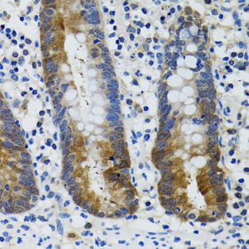 Polyclonal Rabbit anti-Human HSPH1 / HSP105 Antibody (IHC, WB)
