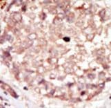 Polyclonal Rabbit anti-Human HIPK3 / FIST Antibody (aa1127-1156, IHC, WB)