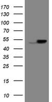 EPHX1 / Epoxide Hydrolase 1 Antibody (aa21-230, clone OTI2C1, Carrier-free)