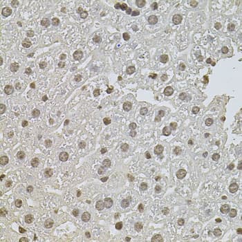 Polyclonal Rabbit anti-Human ZNF408 / PRDM17 Antibody (IHC, WB)