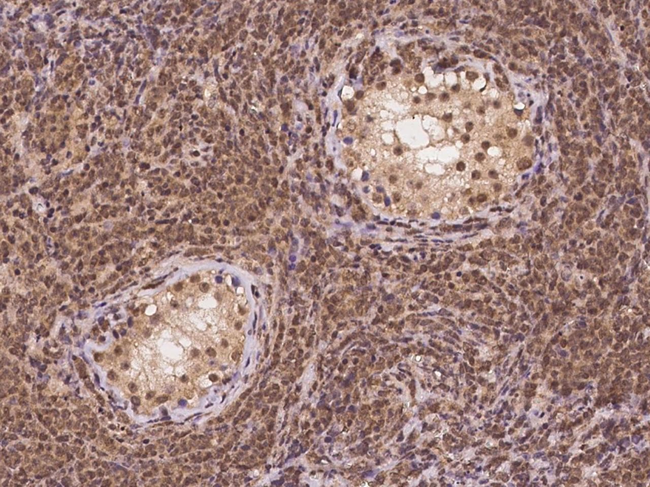 CDCA8 / Borealin Antibody