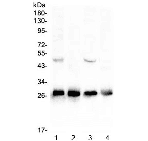 CALB1 / Calbindin Antibody