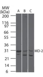 Polyclonal Rabbit anti-Human LY96 / MD2 / MD-2 Antibody (IHC, WB)