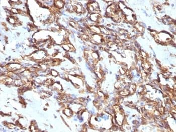 Vimentin Antibody (clone VM1170)