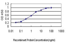 Monoclonal Mouse anti-Human MARK2 Antibody (clone 3B12, WB)