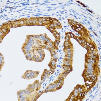 CHAF1B / CAF1 Antibody