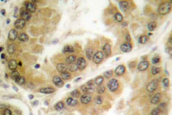 HDAC7 Antibody (Gly932)