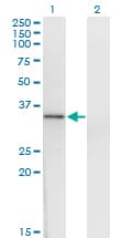 HOXD1 Antibody (clone 4F4)
