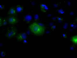 LIPG / Endothelial Lipase Antibody (clone OTI2A5)