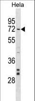 Polyclonal Rabbit anti-Human NARF Antibody (aa134-160, WB)