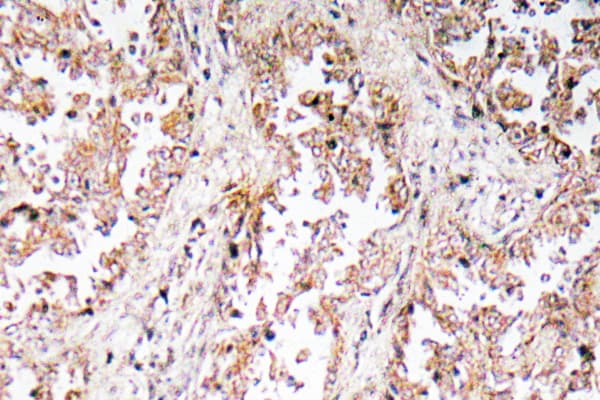 Polyclonal Rabbit anti-Human UCP2 Antibody (His113, IHC)
