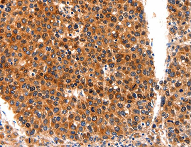 FGFR1 / FGF Receptor 1 Antibody
