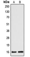 CYB5A / Cytochrome b5 Antibody (Internal)