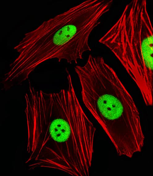 Polyclonal Rabbit anti-Human PHAP III / ANP32E Antibody (aa21-44, IF, WB)
