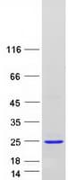 Human NUDT2 Protein (Recombinant Myc-DDK (Flag))