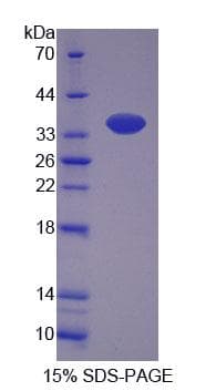 Rat HAVCR1 / KIM-1 Protein (Recombinant His)
