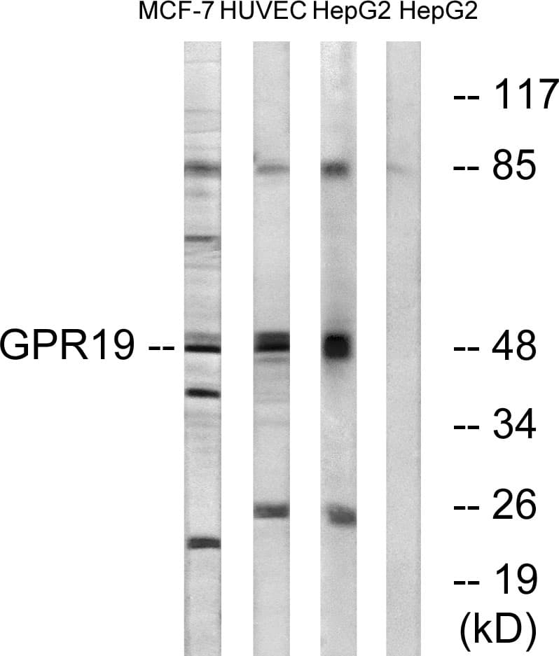 GPR19 Antibody (aa361-410)