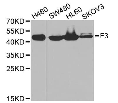 F3 / CD142 / Tissue factor Antibody
