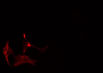 HMMR / CD168 / RHAMM Antibody