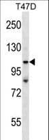 Polyclonal Rabbit anti-Human TP53BP2 / ASPP2 Antibody (aa93-122, WB)