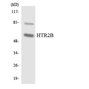 HTR2B / 5-HT2B Receptor Antibody (aa6-55)